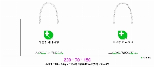 ���ι� | ���̼��ι�_���������ܰ� 250x100x200mm