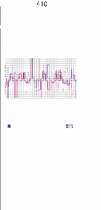 ���� �м� �̿� Ű�� | �ֹ����۱⺻�� ���ڹ� 360x100x360mm